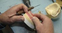 partial dentures