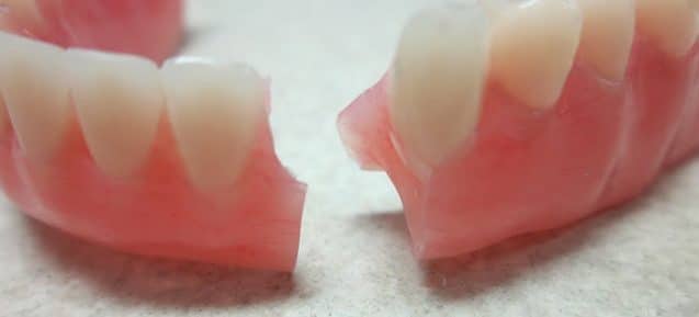 Cracked or Broken Denture Repairs